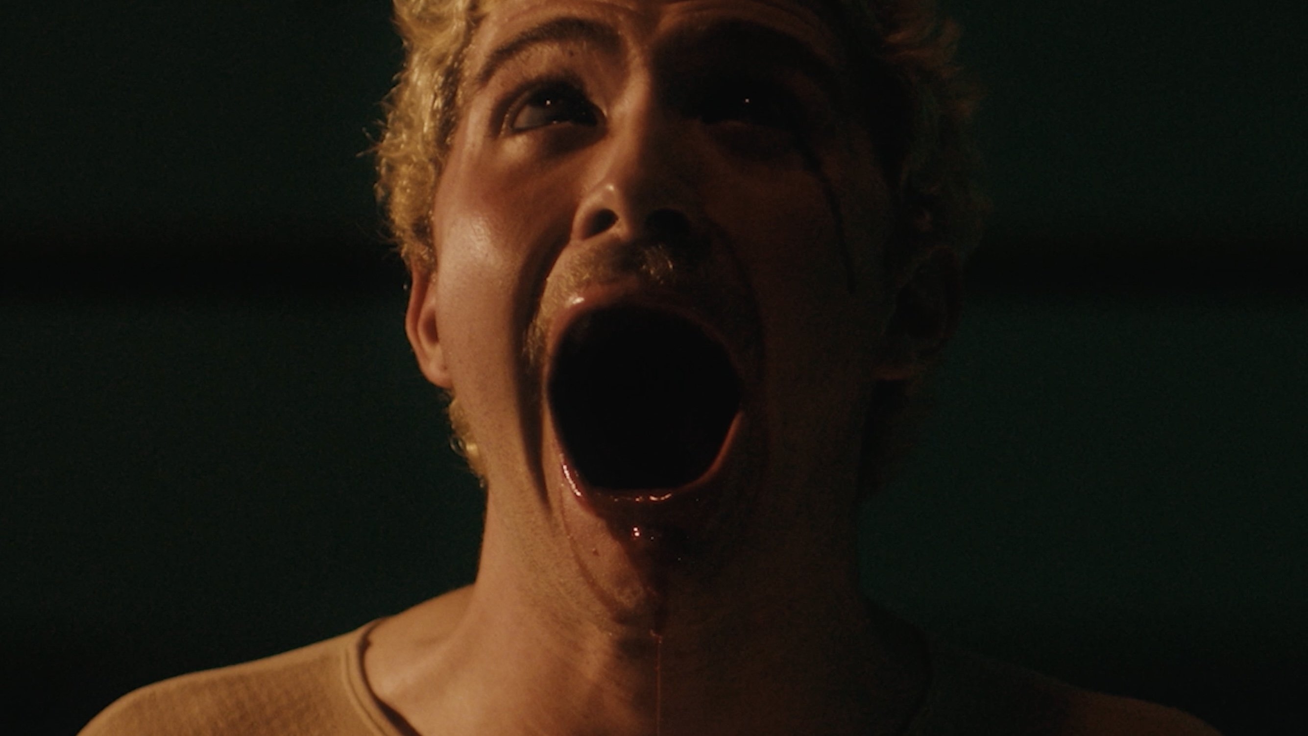 Bloodletting