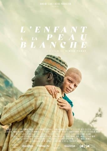 The Boy with White Skin